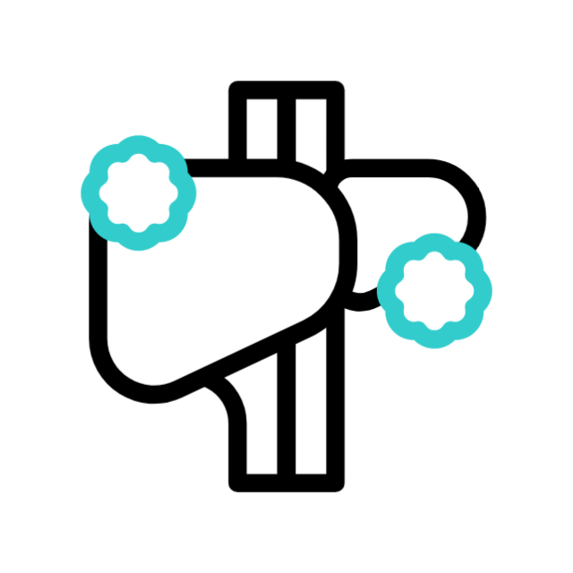 Atrial fibrillation animated icon Atrial fibrillation animated icon