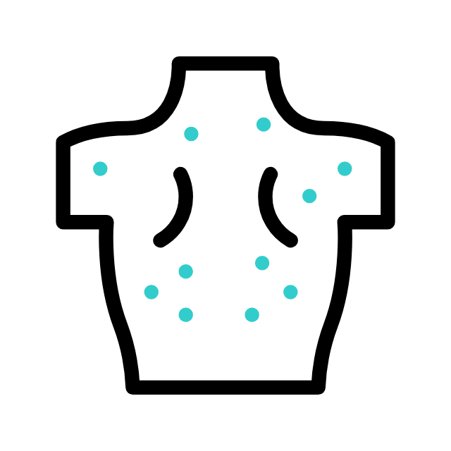 Blackhead animated icon Blackhead animated icon